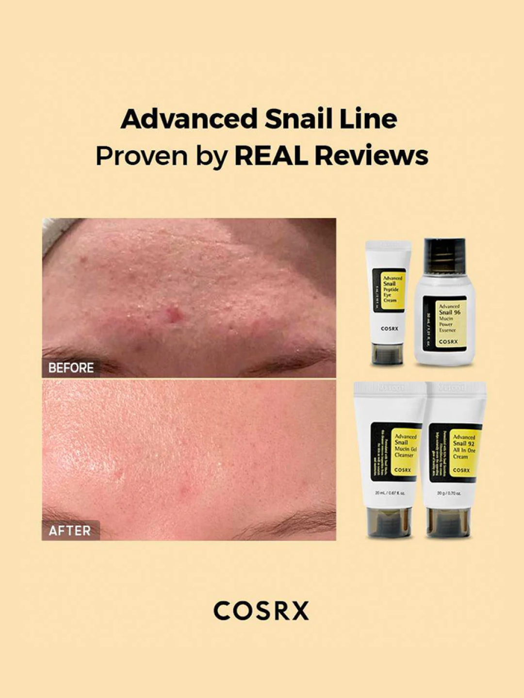 COSRX | All About Snail Kit 4Step